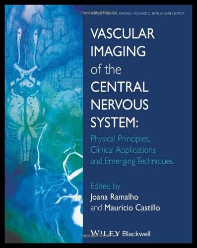 【预售】vascular imaging of the central nervous system: p