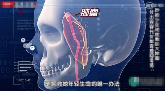 刘静明(左)在手术中图片由北京电视台"生命缘"节目组提供张家亮正在为