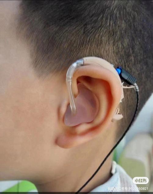 为什么听损儿童更需要趁早佩戴助听器