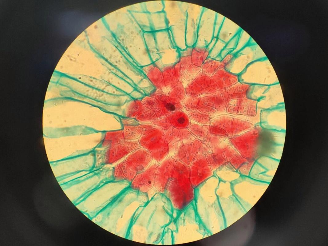 梨果实切片示石细胞 植物学实验