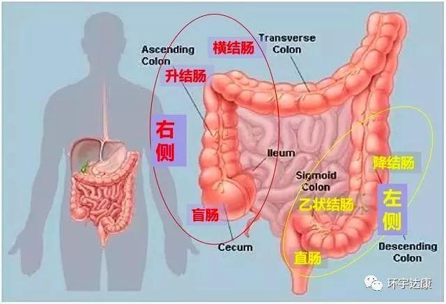 左侧病灶包括:降结肠,乙状结肠,直肠右侧病灶包括:升结肠,横结肠,盲肠