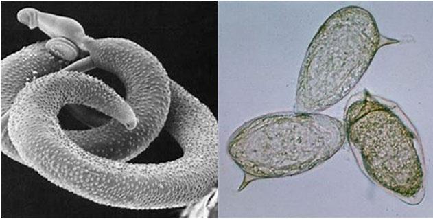 曼氏血吸虫(左)和虫卵(右)的显微照片.图片来源:wikipedia,msu