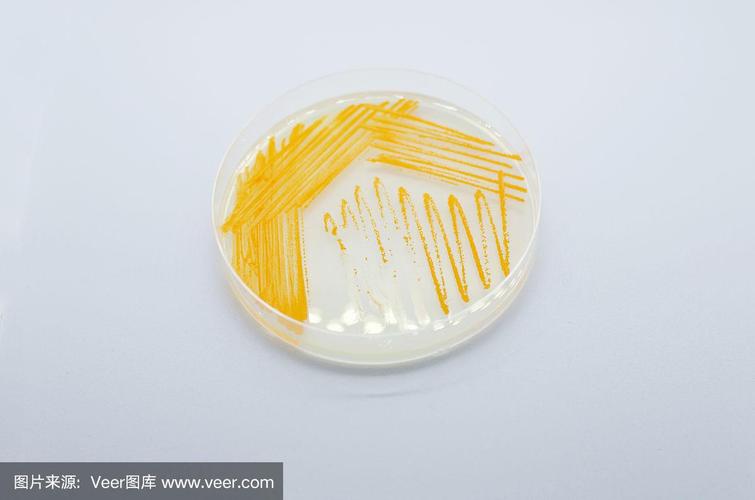 橘色的放线菌菌落在琼脂平板上