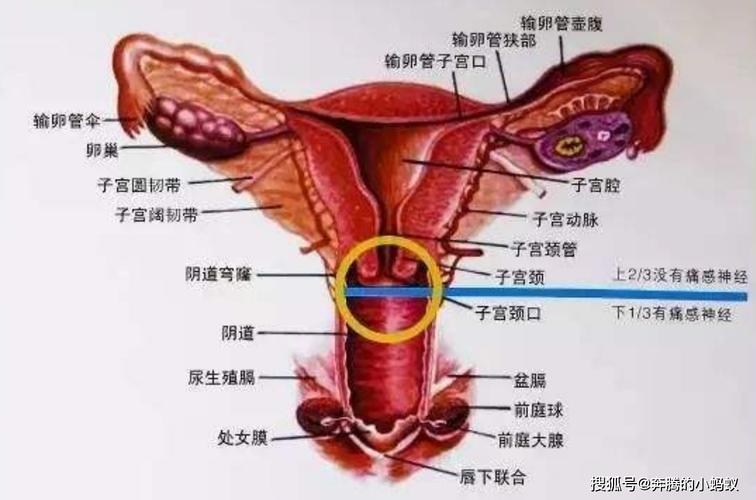 从而引起盆腔炎,附件炎,阴道炎等一些妇科疾病,所以一旦发现宫颈息肉