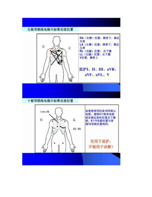 【图文】心电监护仪的临床应用.doc 19页