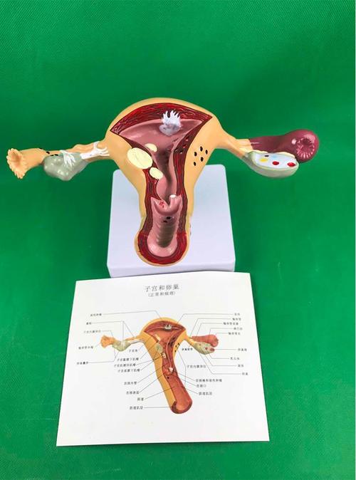 人体子宫模型教具模具卵巢解剖病理医学女性仿真女性生殖模器b款双侧