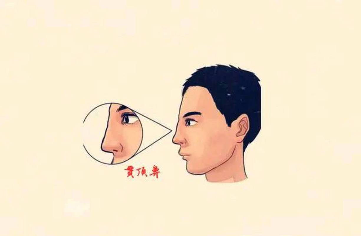 5,贯顶鼻  所谓的"贯顶鼻"在相学中也称"伏犀鼻",这种鼻相的重要特征