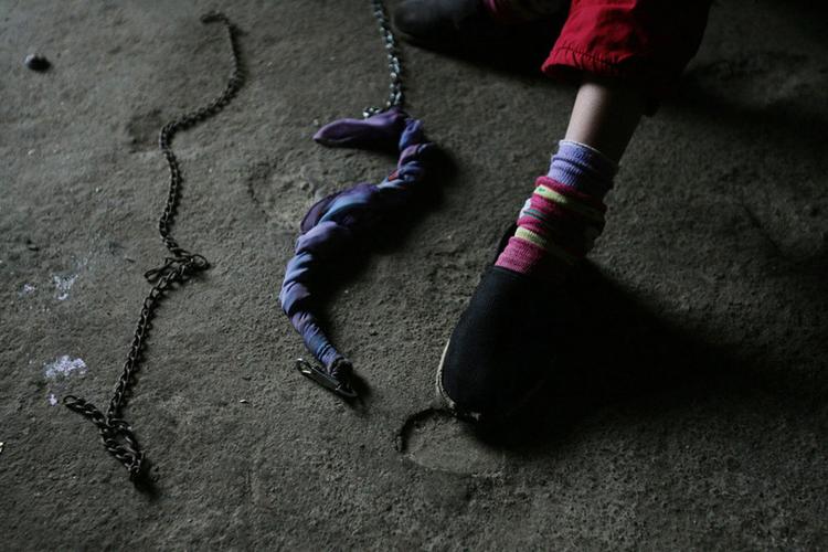 家人无力看管12岁女孩被铁链锁颈7年