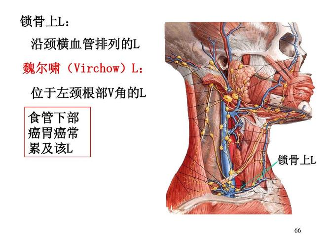 锁骨上l: 锁骨上l 沿颈横血管排列的l 沿颈横血管排列的l 魏尔啸