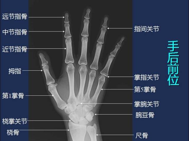 常规x线影像解剖大全-健康频道-手机搜狐