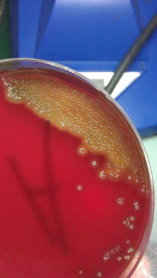 革兰阳性球菌,如题,如果不做其他鉴定,光看血平板的话像是溶血性