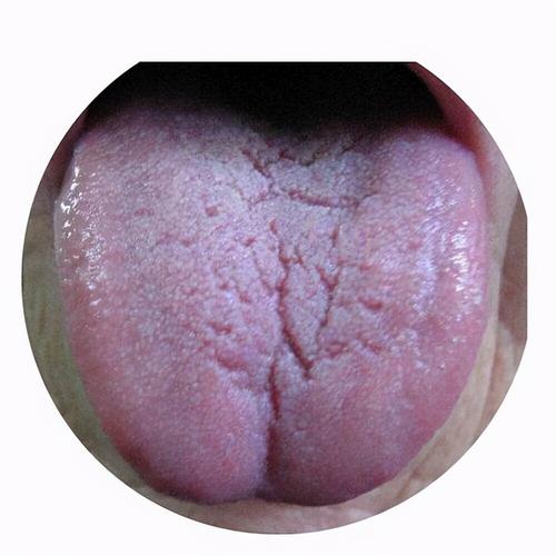 舌苔发白是什么原因呢 人工智能舌诊小程序-小蚊子百科网