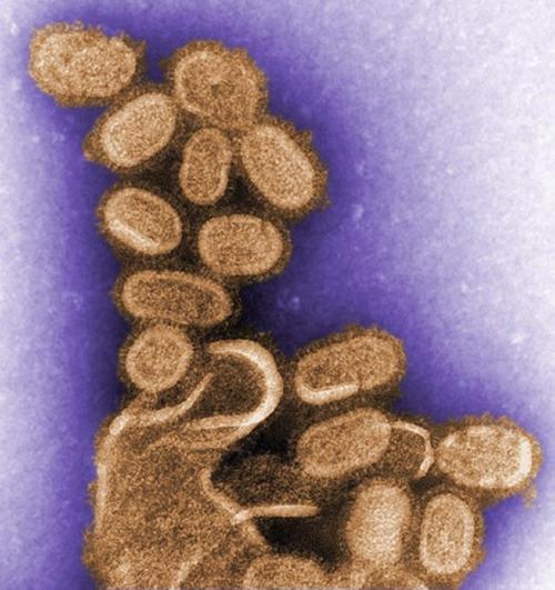 1918年西班牙流感,最致命的流行病_病毒