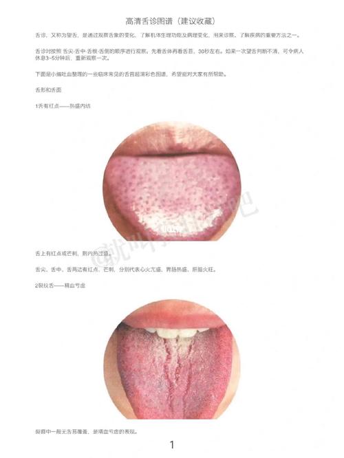 舌诊图谱