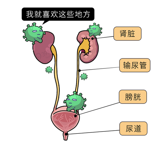 如尿道,膀胱,肾脏等感染可发生在泌尿系统的不同部位也是泌尿外科最