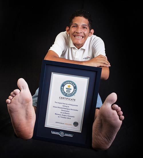 委内瑞拉小伙拥有世界上最大的脚