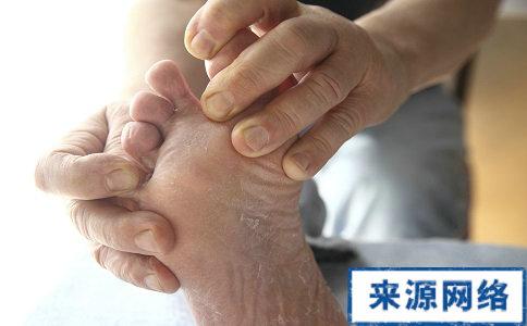 香港脚治疗方法 香港脚食疗方