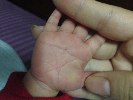 问:这个掌纹啥意思?有点特别,出生11天小婴儿的手
