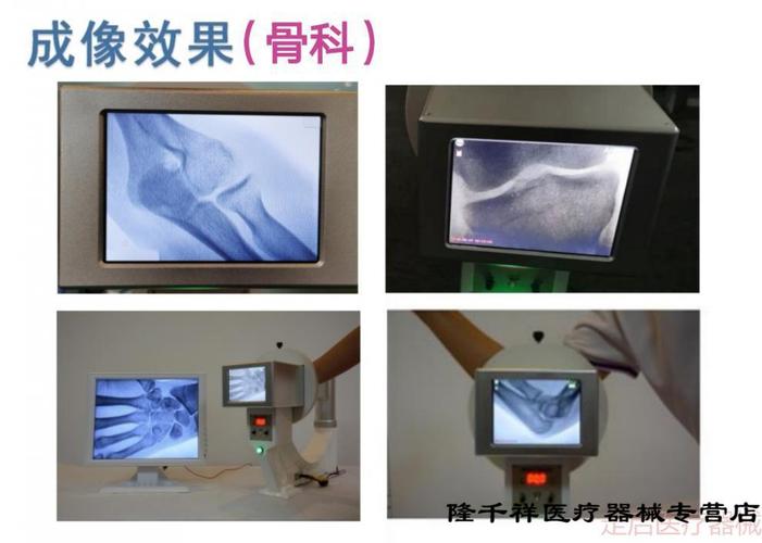 小型x光机透视仪器高清便携式骨科x光机微焦点wj8工业x光射线机 jc1