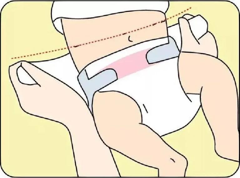 如何正确给宝宝换纸尿裤.|||1.解开穿着的纸尿裤 正常打开 - 抖音