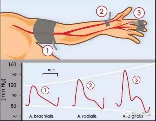 然后根据整体化的上臂袖带装置的初始读数转换为肱动脉绝对血压值
