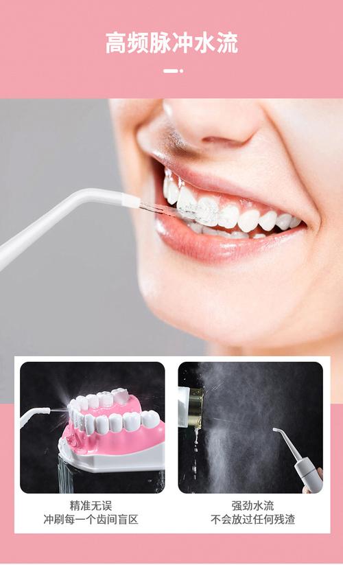 冲牙器家用洗牙器便携牙结石口腔牙齿牙缝冲洗器大冲力家用水牙线