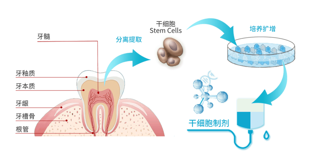 2000年,gronthos 等科学家从脱落的儿童乳牙中发现了牙髓干细胞.