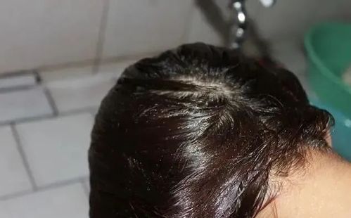 洗完头发还是油腻腻洗发水护发素怎么用才最正确