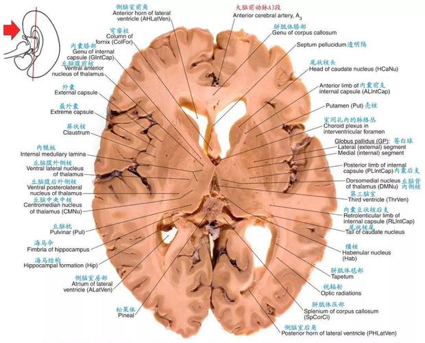 解剖颅脑断层解剖图谱标注到位值得收藏