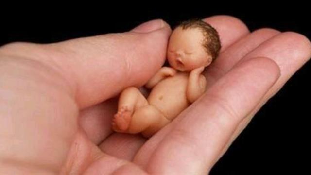 世界上"最小的婴儿",还没有巴掌大,捧在手心可爱到爆!