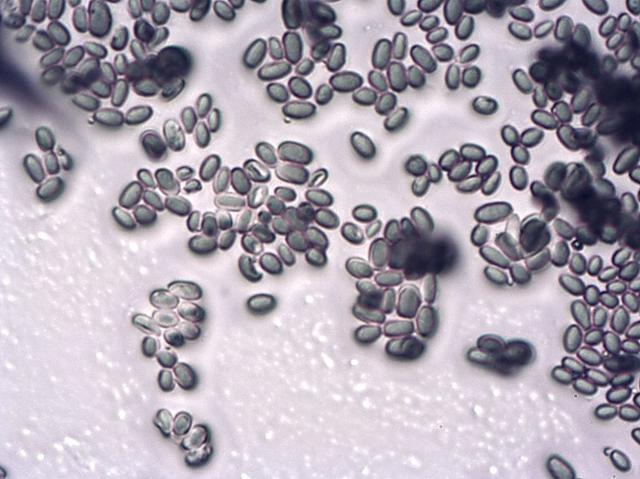 图注:显微镜下的霉菌孢子