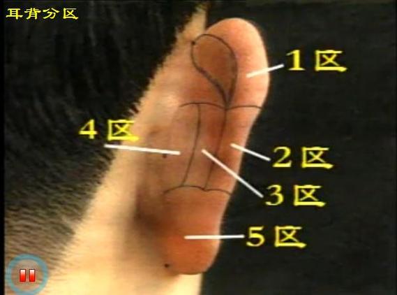 耳背穴位耳垂穴位对耳屏穴位耳屏穴位耳甲腔穴位三角窝穴位对耳轮穴位