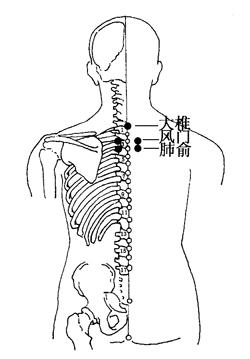 图6-1-1大椎,风门,肺俞