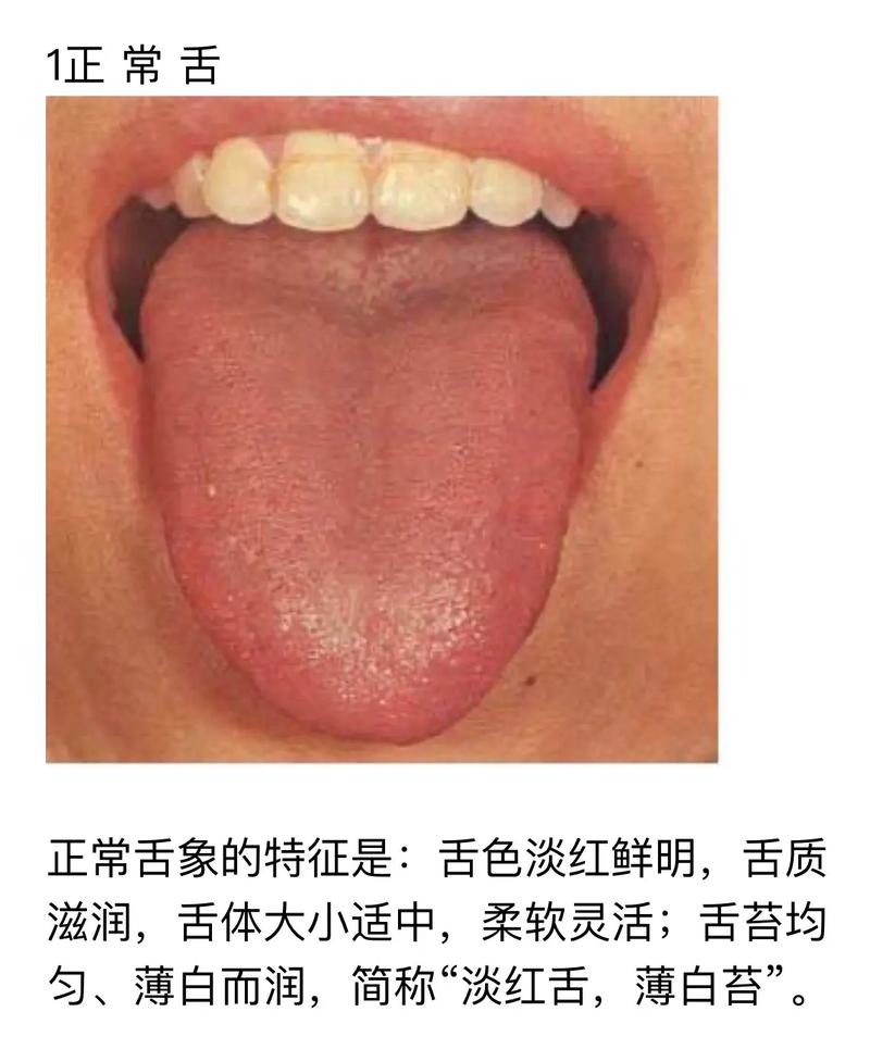 舌诊辨证图谱 - 抖音