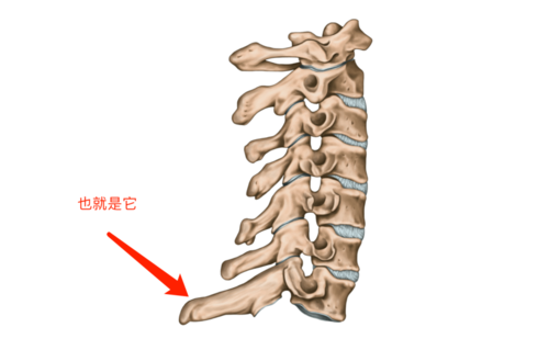 注意,这里的突起主要是第7颈椎的棘突,是骨头的一部分,也是颈椎里最长