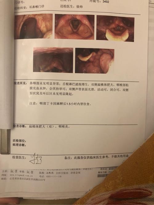 舌根淋巴滤泡增生伴脖子淋巴结肿大诊断咽喉炎是否需要北京确诊