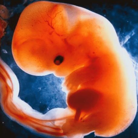 (一)生育间隔在6个周期(即6个月)以内,低出生体质量儿,早产,自然流 