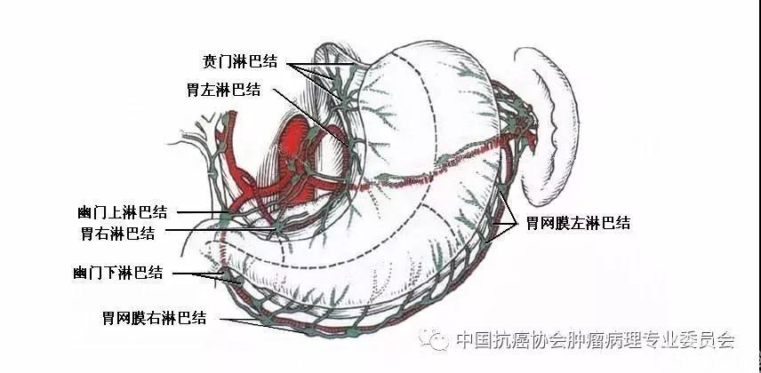 医生未送检分组淋巴结,应按淋巴结引流区域对胃周淋巴结进行分组(图4)