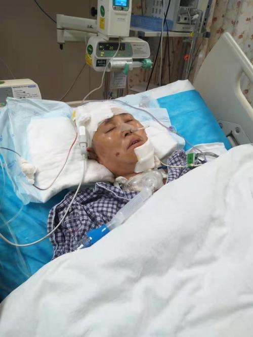 湖南56岁的母亲不幸发生车祸至今在icu昏迷不醒后续高昂的医疗费用