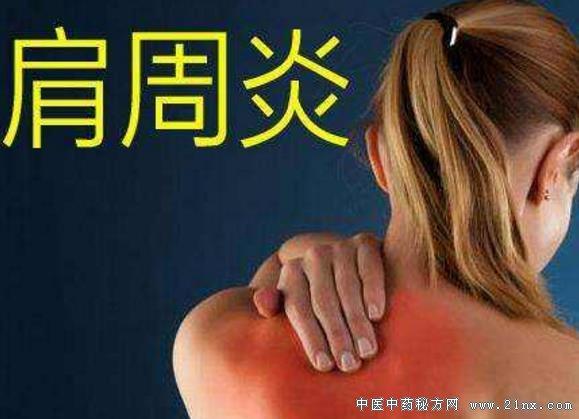 张光武《肩膀疼痛巧应对》20180512饮食养生汇视频