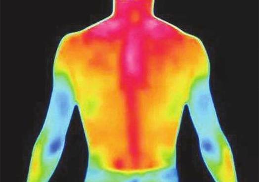 人体红外辐射成像图