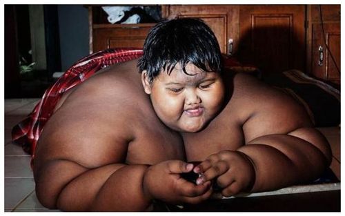 印度男孩10岁时胖过400斤减肥一年半如今长这样
