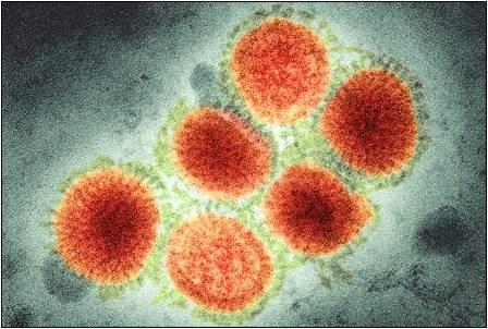透过显微镜看甲型h1n1流感病毒