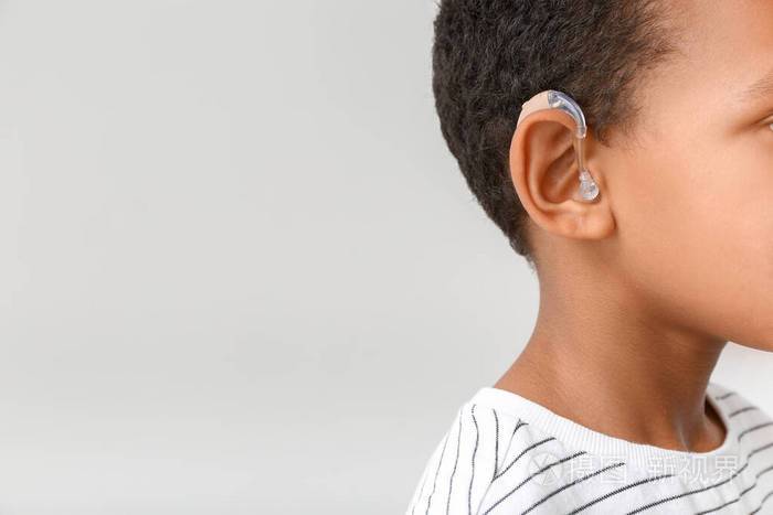 浅色背景下带助听器的非洲裔美国小男孩