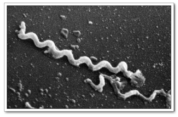 (梅毒螺旋体是梅毒的病原体,因其透明,不易着色,故又称苍白螺旋体.