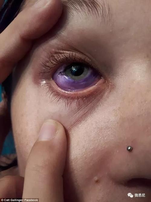 澳美女模特做眼球纹身后失明!眼睛发炎竟流出紫色"泪水"!