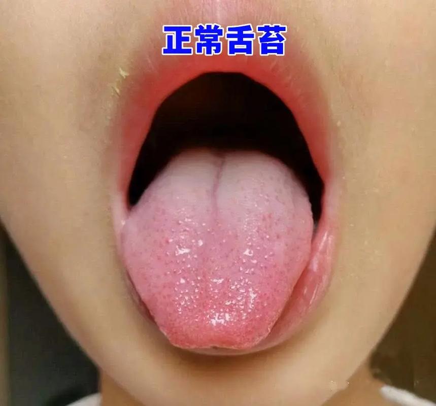 三甲医院儿科中医叫大家看孩子舌苔!您家是.1,正常孩子的舌苔 - 抖音