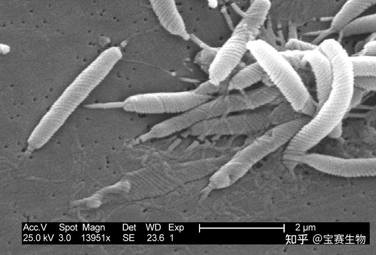幽门螺杆菌hp是一种单极,多鞭毛,末端钝圆,螺旋形弯曲的细菌(见下图