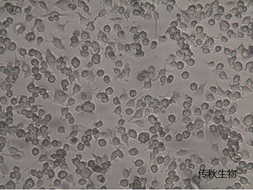 bv2细胞小鼠小胶质瘤细胞培养注意事项