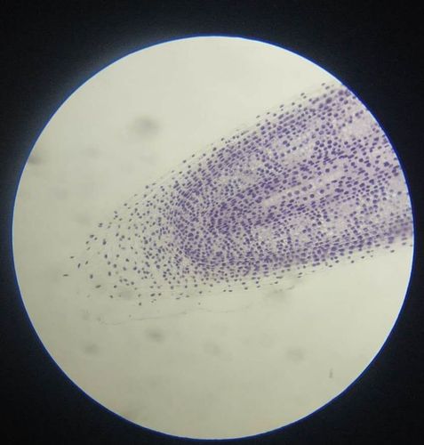 被染色的洋葱根细胞—根冠,分生区,伸长区的细胞都很明显.